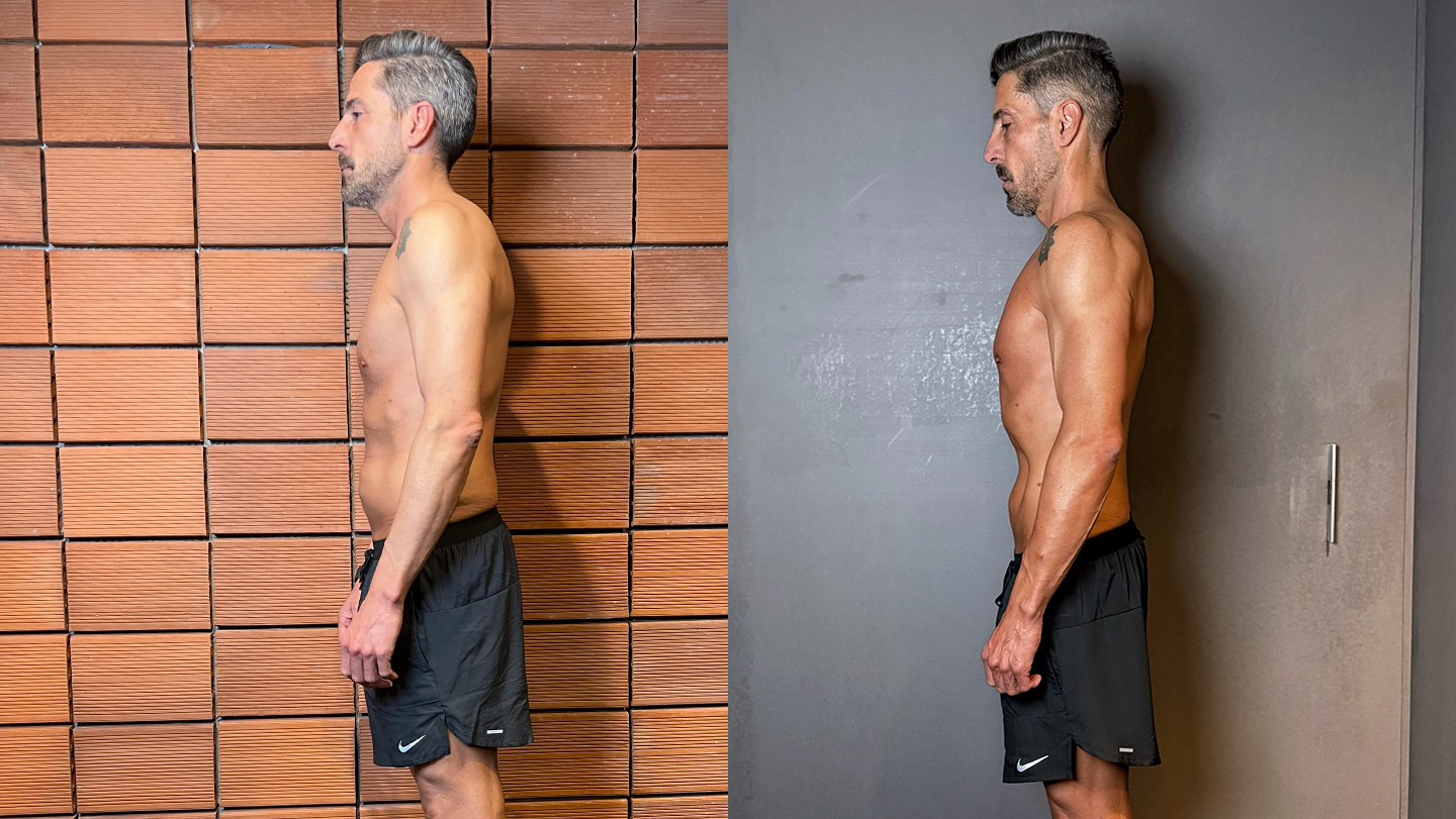 Antes e Depois | Bruno Ribeiro