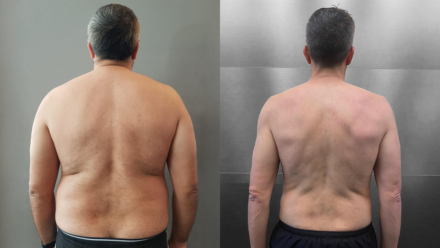 Transformação Fernando Matos | Antes e Depois