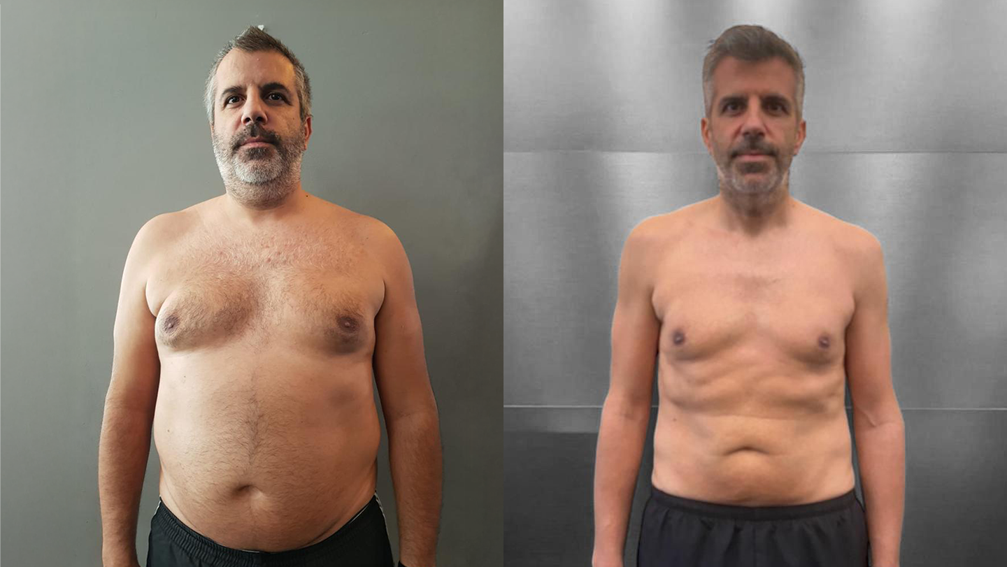 Fernando Matos | Antes e Depois