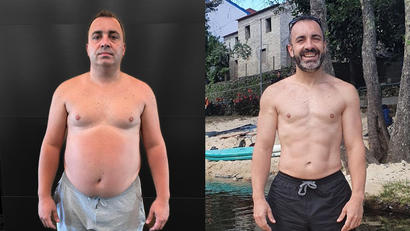 Fernando Silva | Antes e Depois