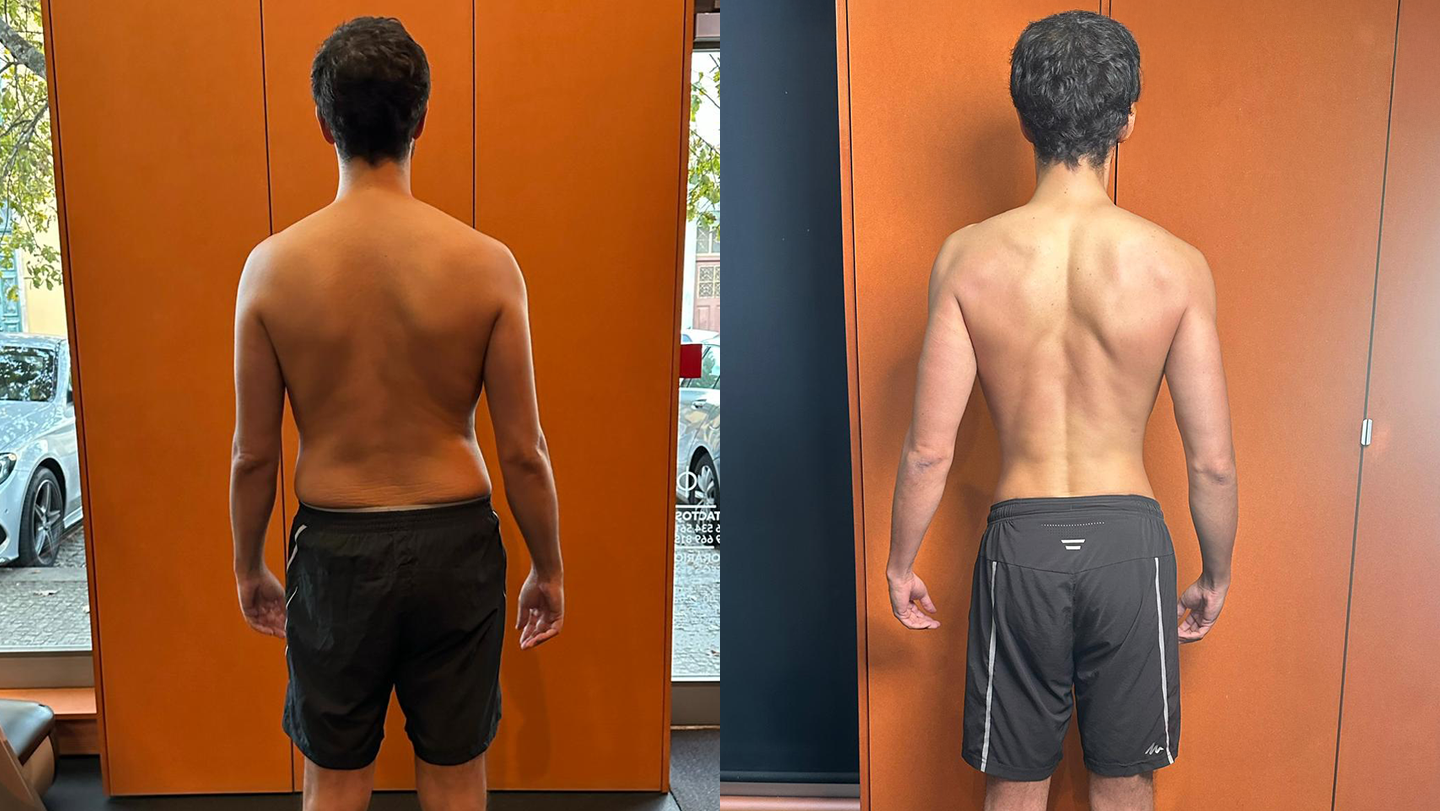 Transformação Hugo | Antes e Depois