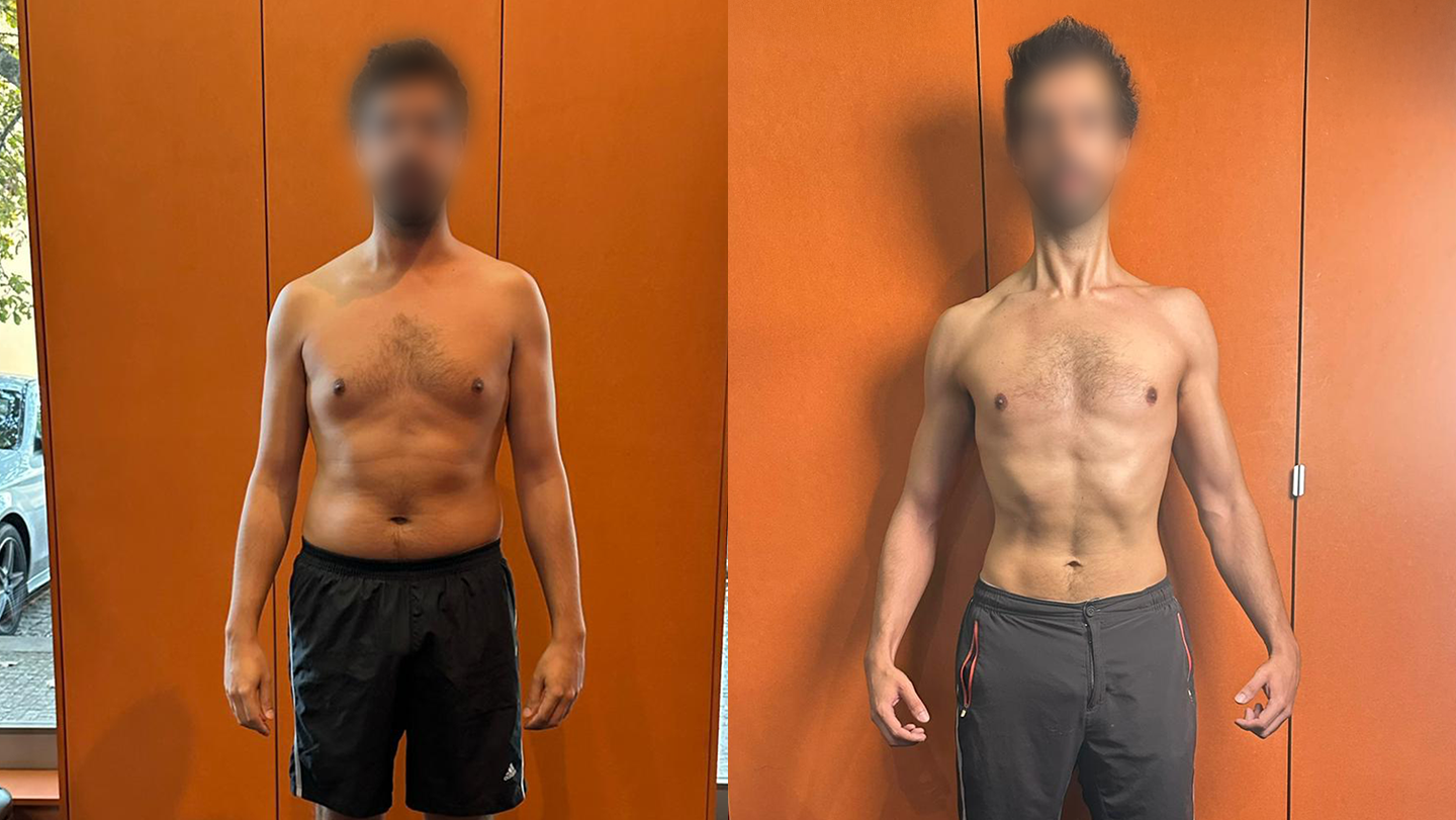 Hugo | Antes e Depois