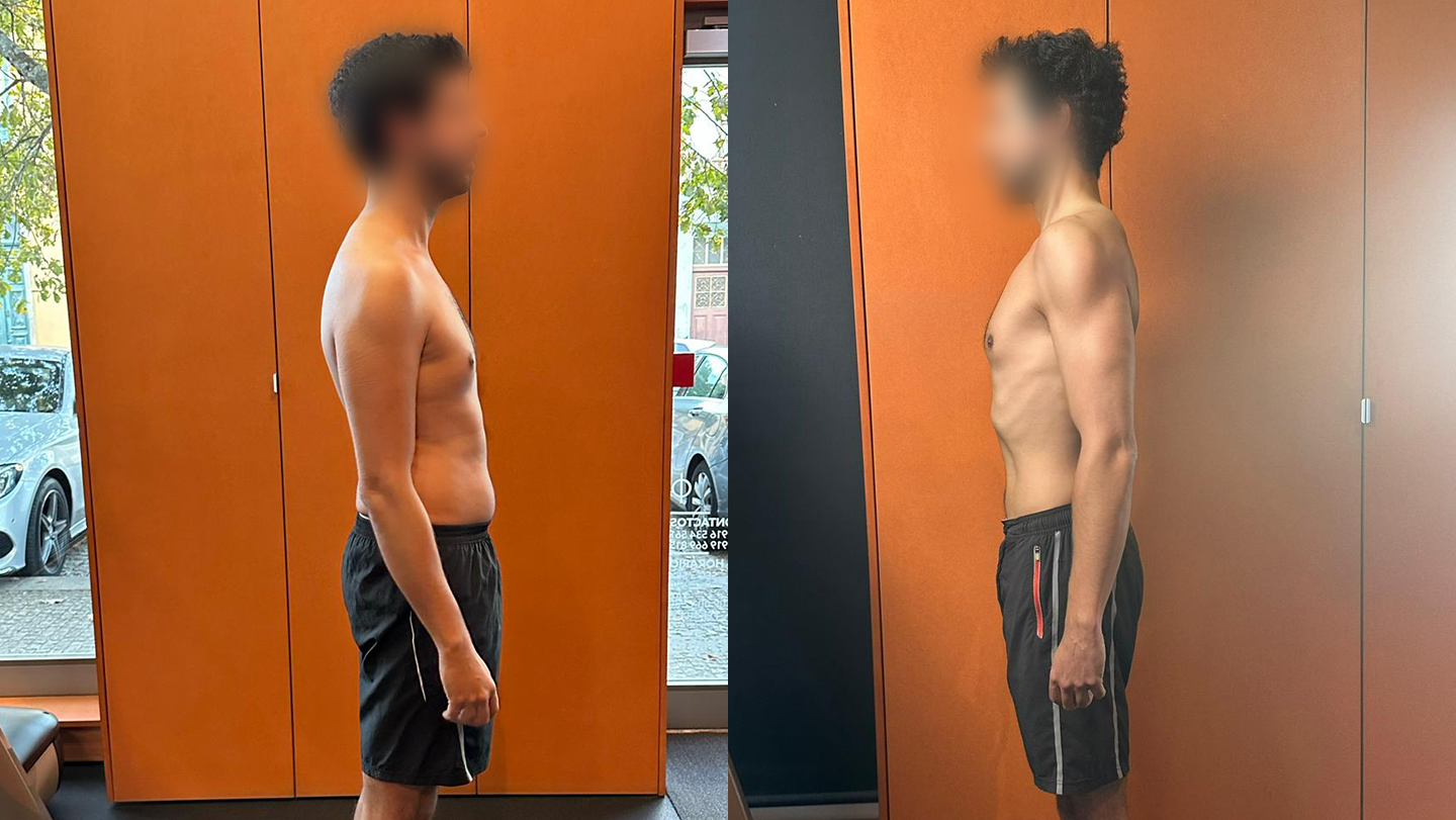 Antes e Depois | Hugo