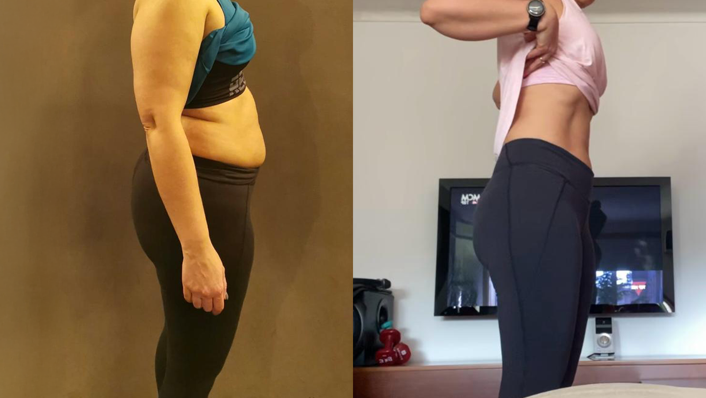 Antes e Depois | Isabel
