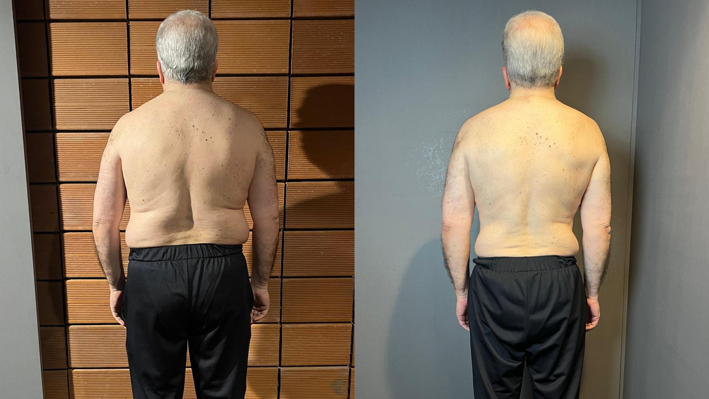 Luís | Antes e Depois