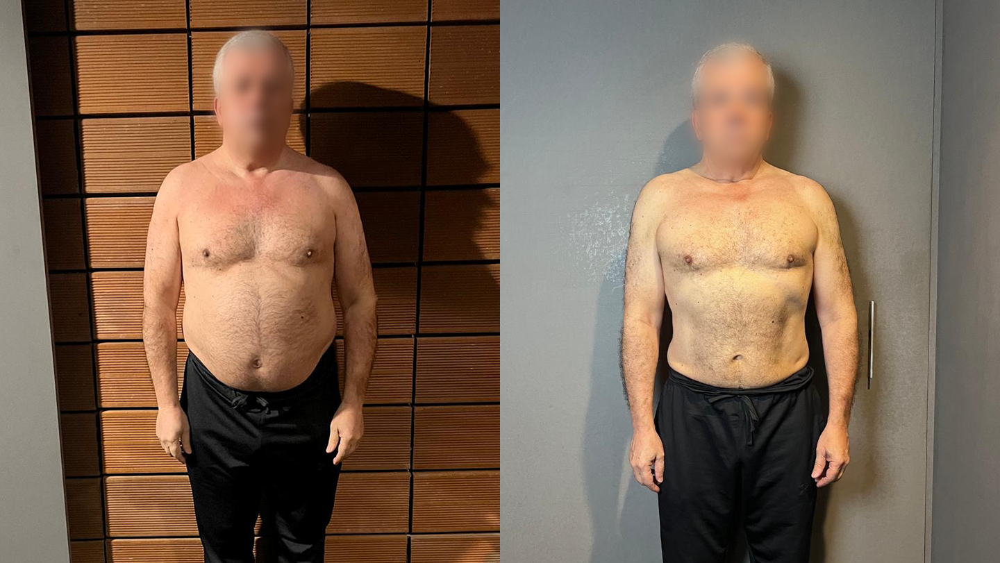 Transformação Luís | Antes e Depois