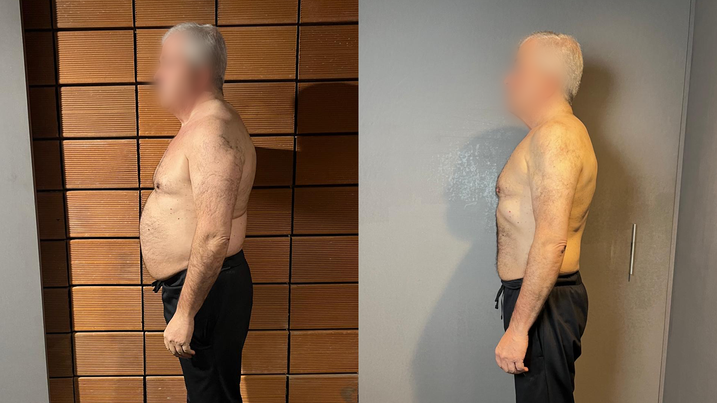 Antes e Depois | Luís
