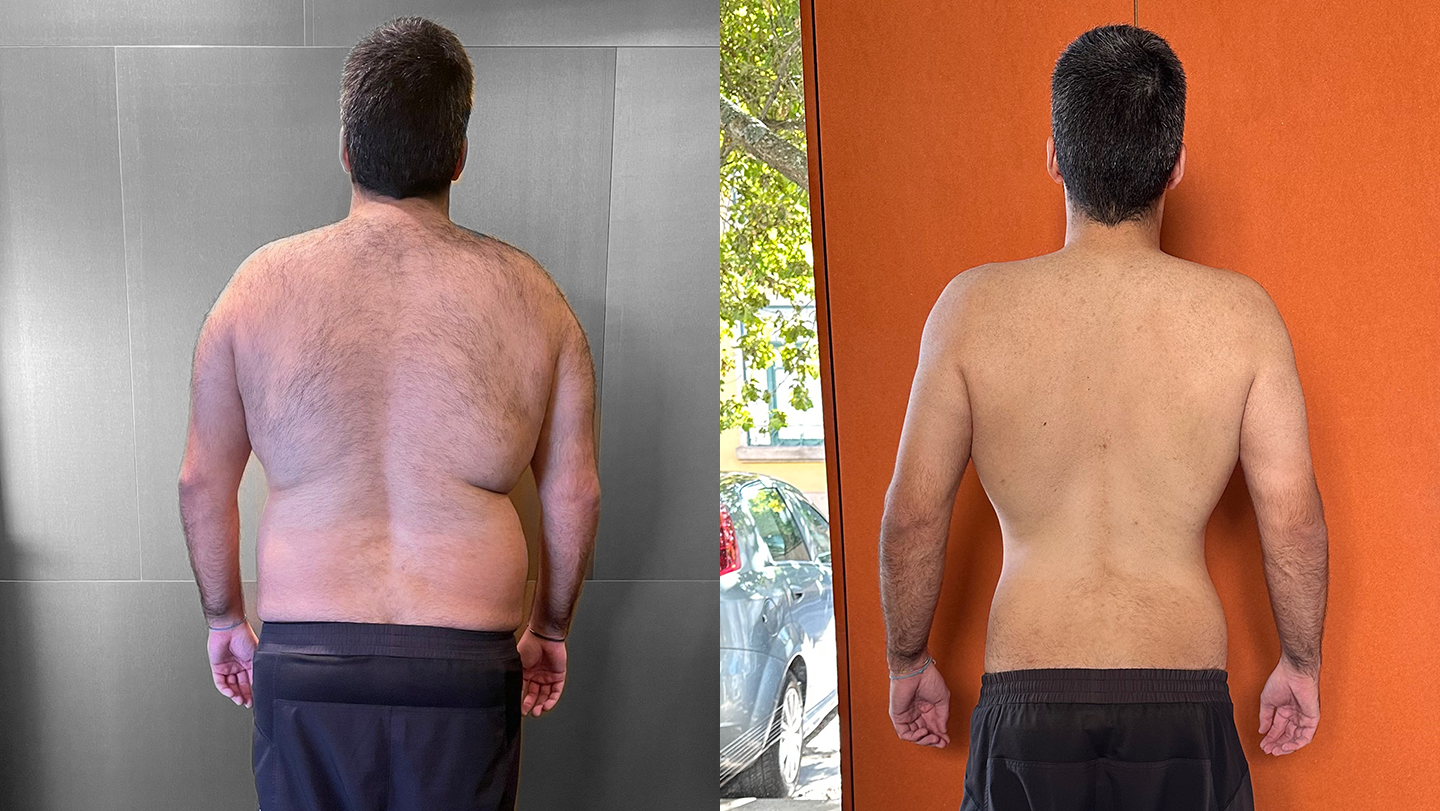 Nuno | Antes e Depois