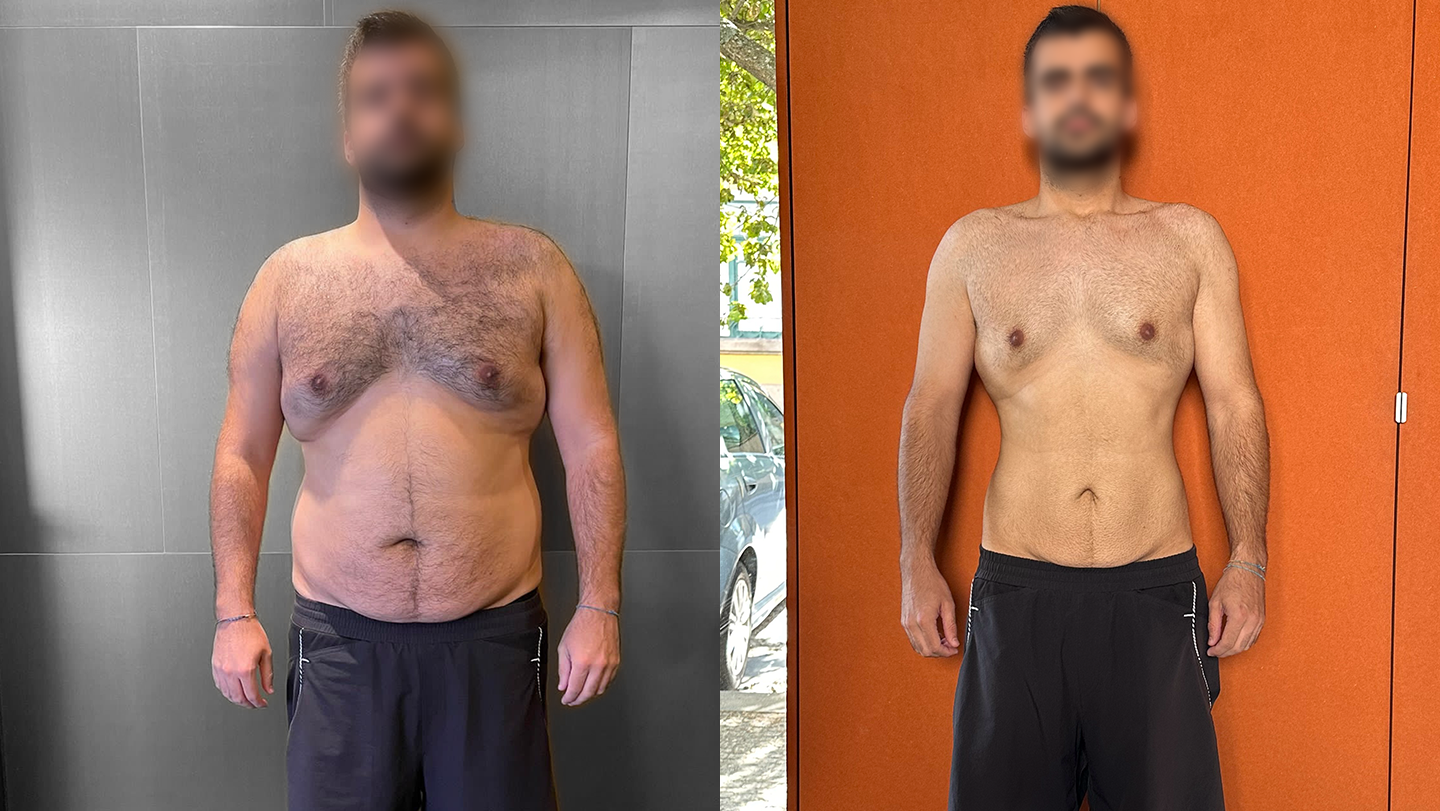Transformação Nuno | Antes e Depois