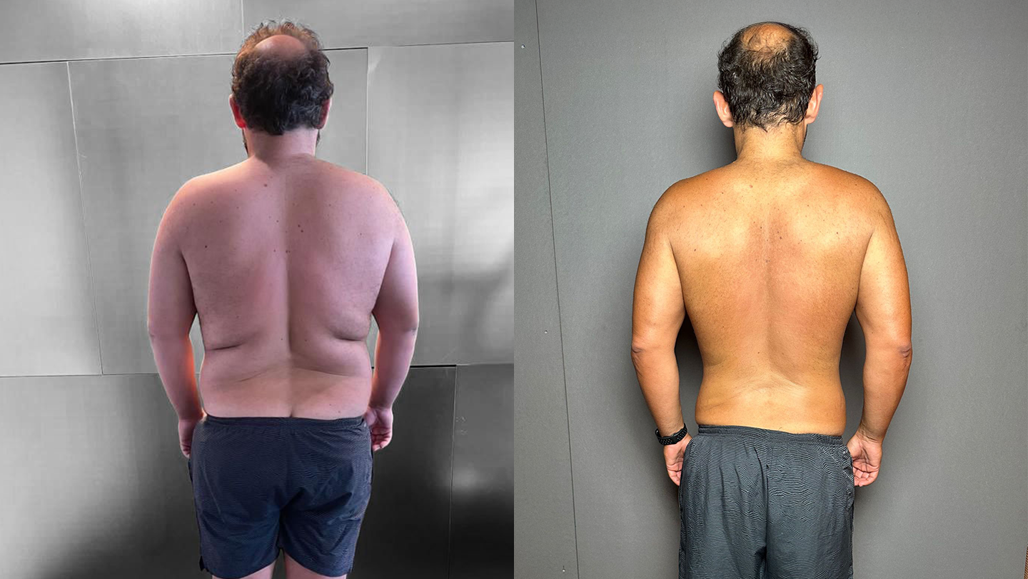 Ricardo | Antes e Depois