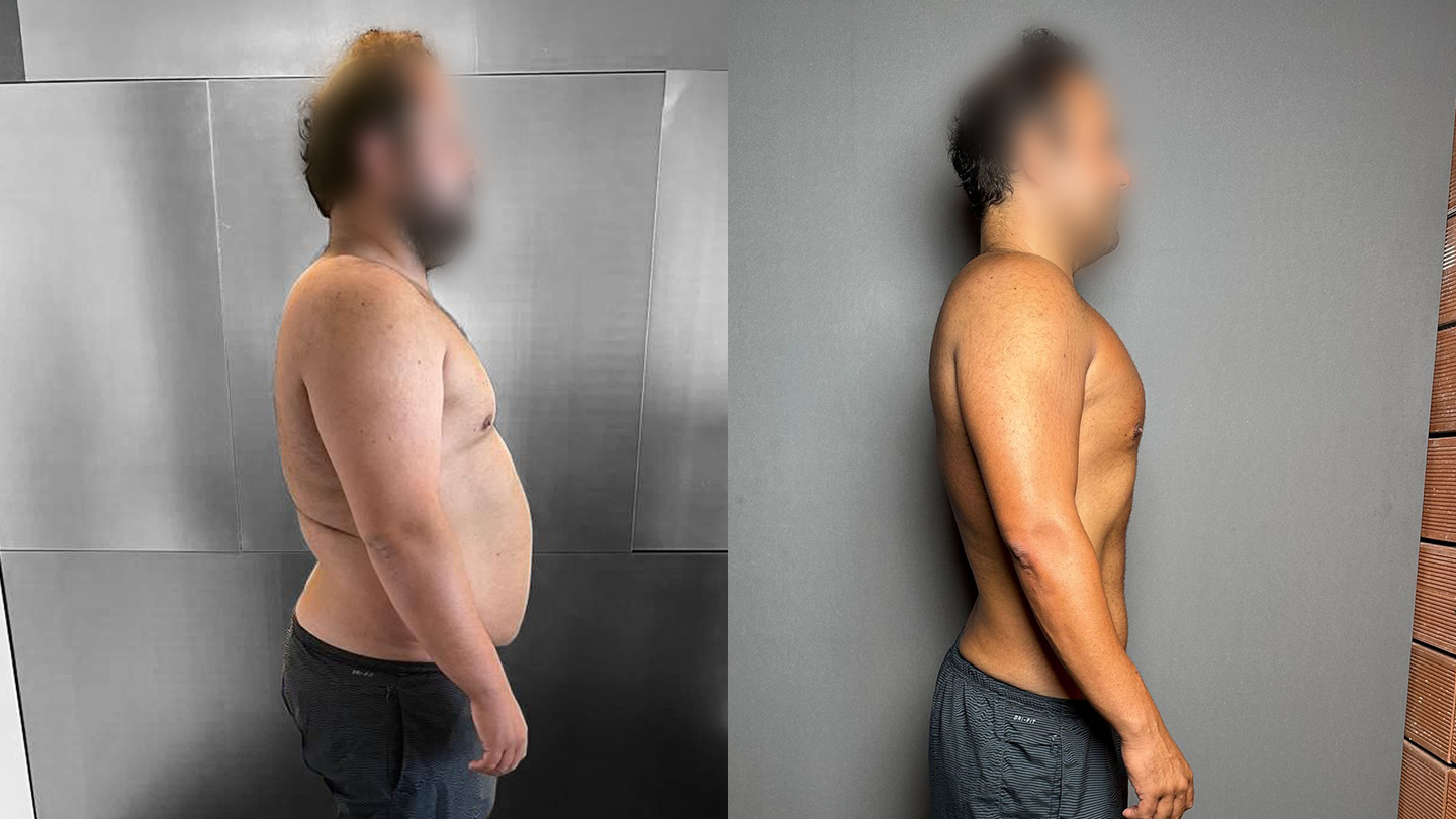 Antes e Depois | Ricardo