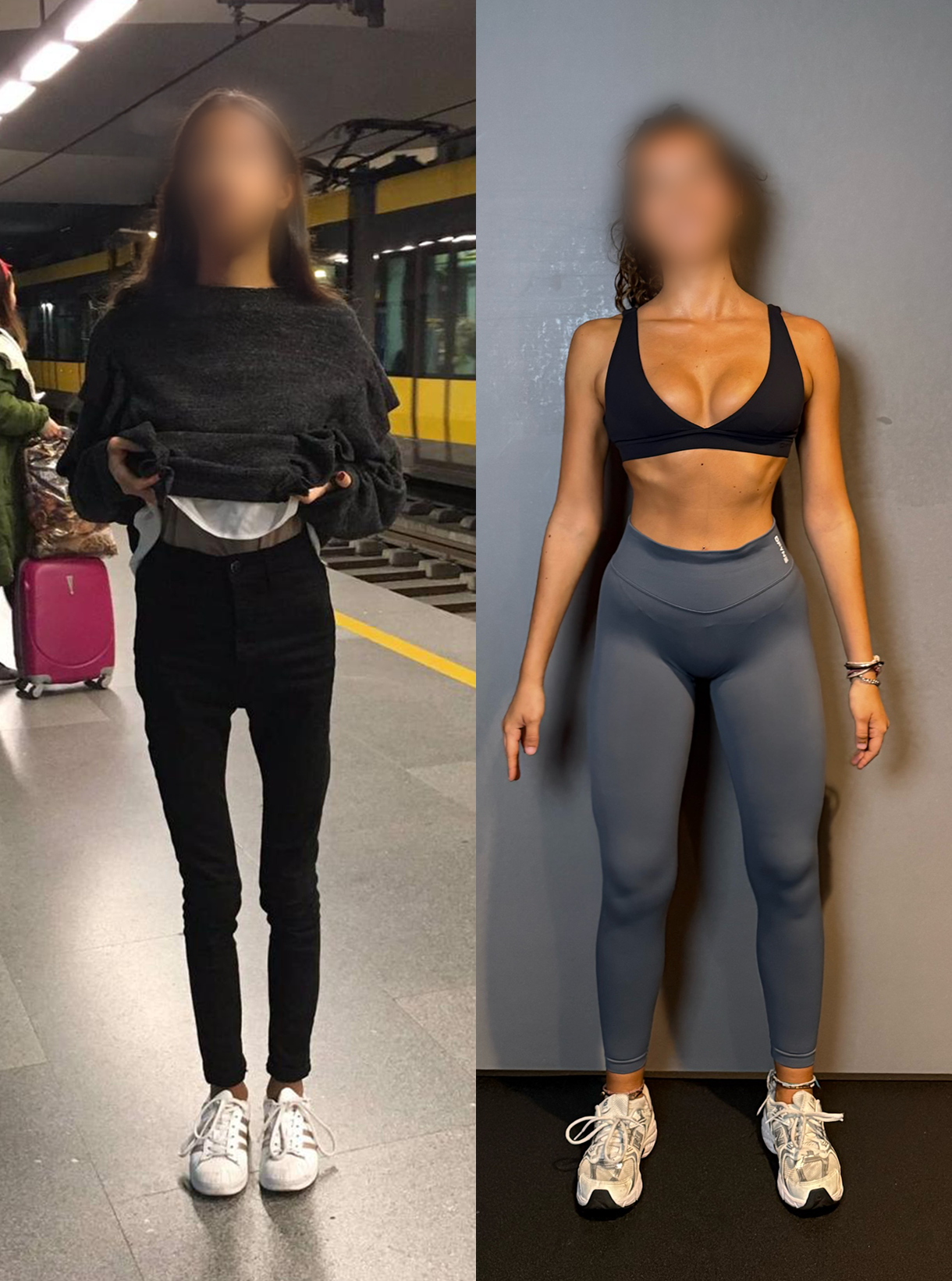 Transformação – Pós-Anorexia: Quando o Treino se Torna Terapia